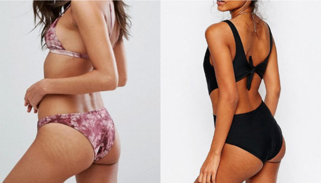 ASOS praised for showing models’ ‘beautiful’ untouched stretchmarks
