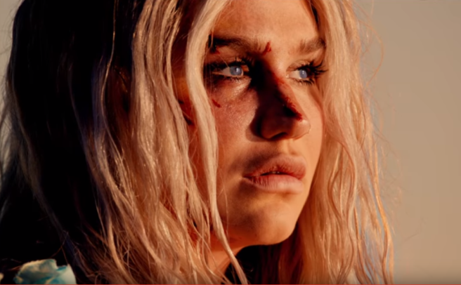 ‘The world is not ready’: Kesha is finally back with a brand new album